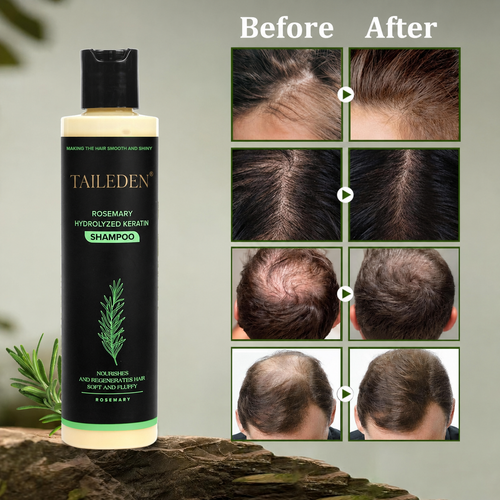 🔥Organic Rosemary Hair Growth Shampoo